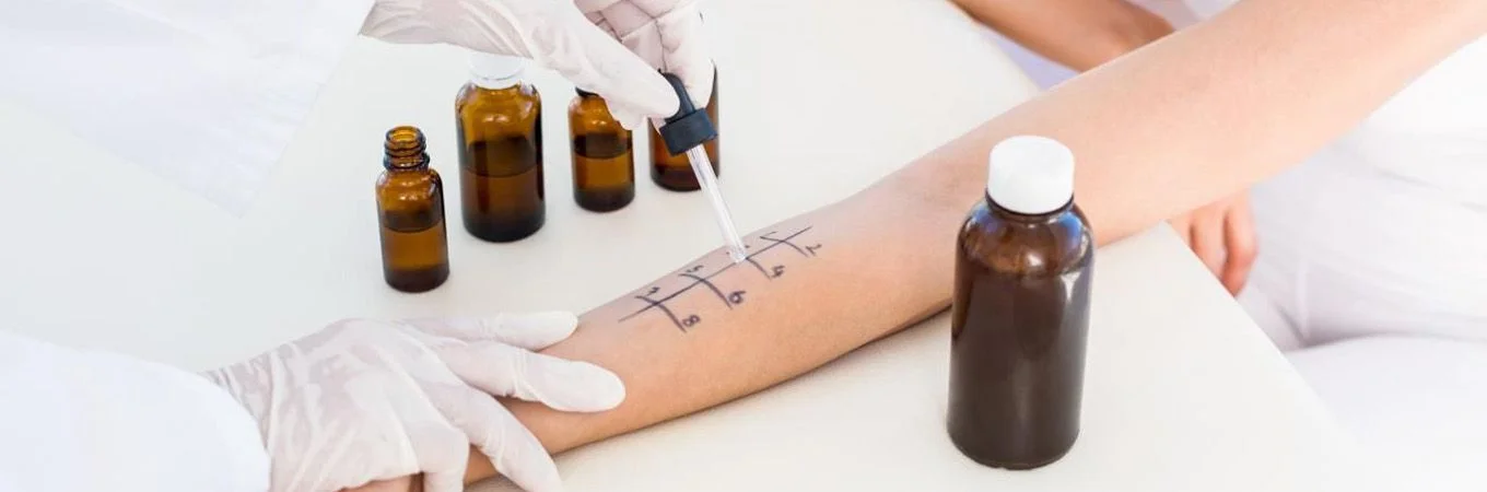 A gloved hand uses a dropper on a marked forearm, surrounded by amber bottles in a clinical setting